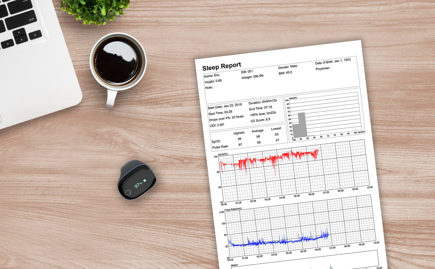 LOOKEE® O2Ring Continuous Ring Oximeter Sleep Report